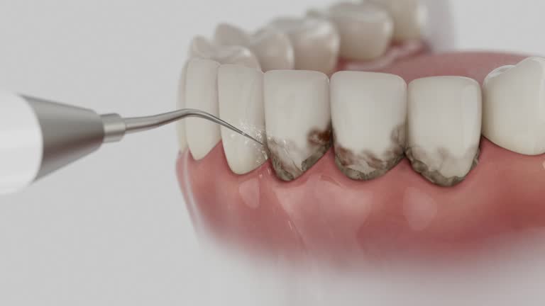 Reliable Dental Implants contractor in Van Buren, MO by Smile Center Dentistry